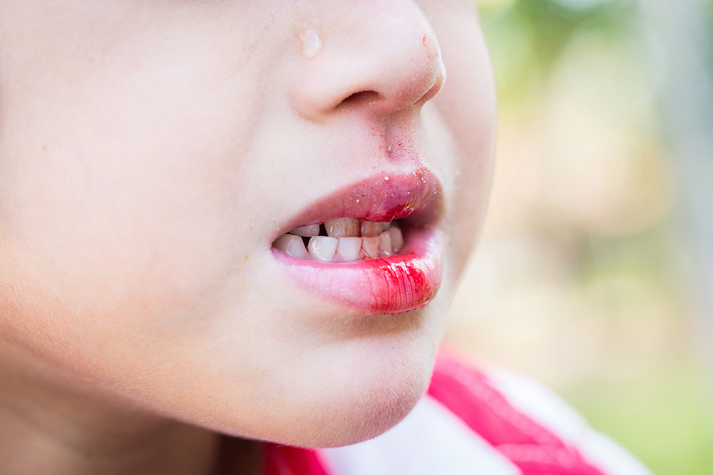 How Do I Know If My Child Has a True Dental Emergency?